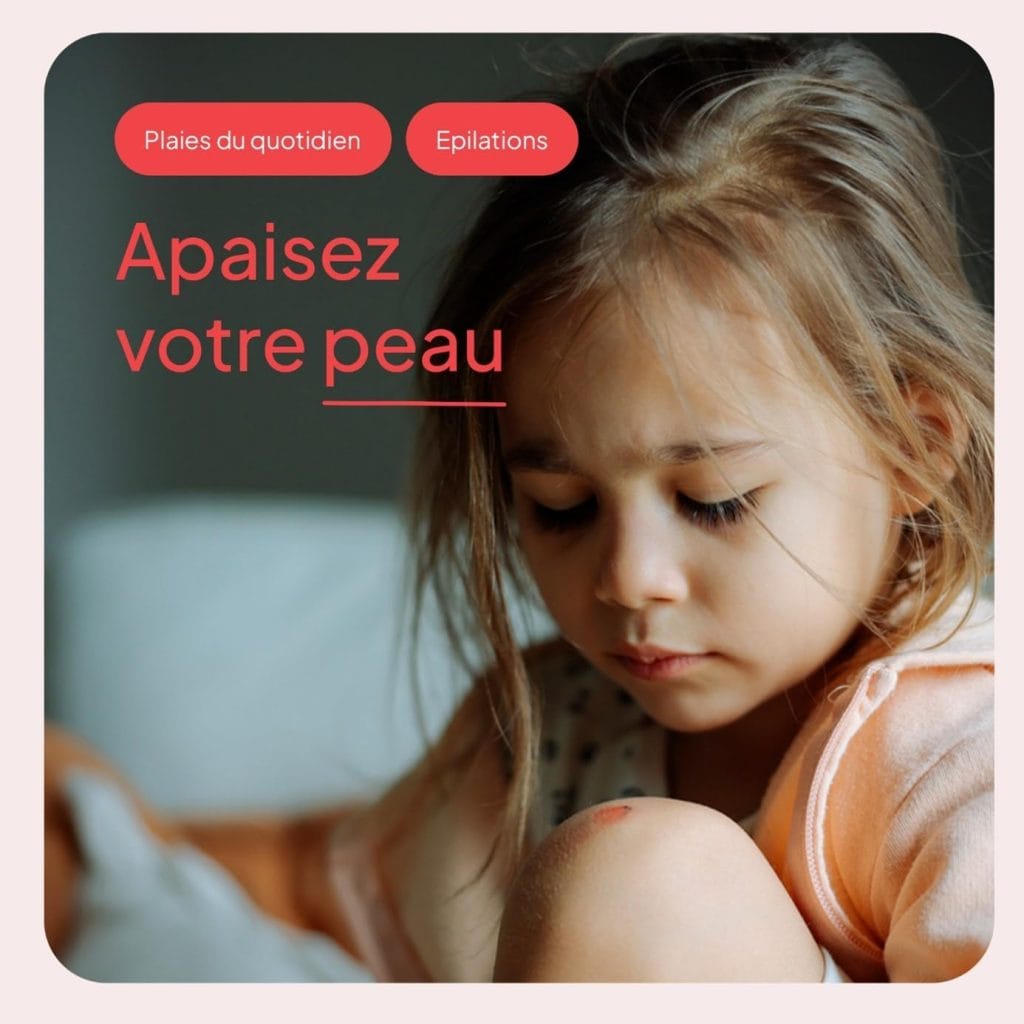 Ialusetcare IBSA Pharma